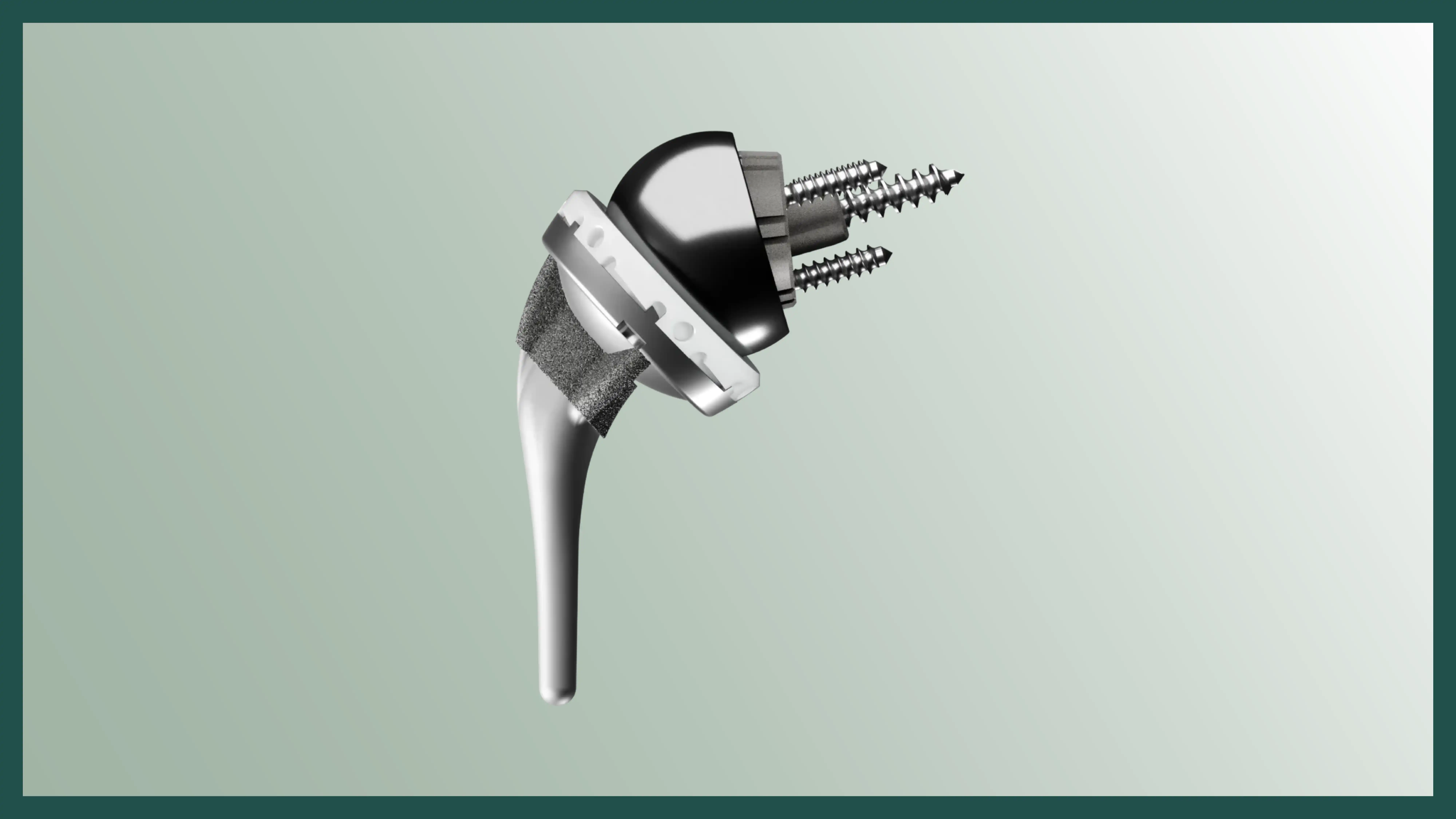 Understanding Reverse Shoulder Replacement