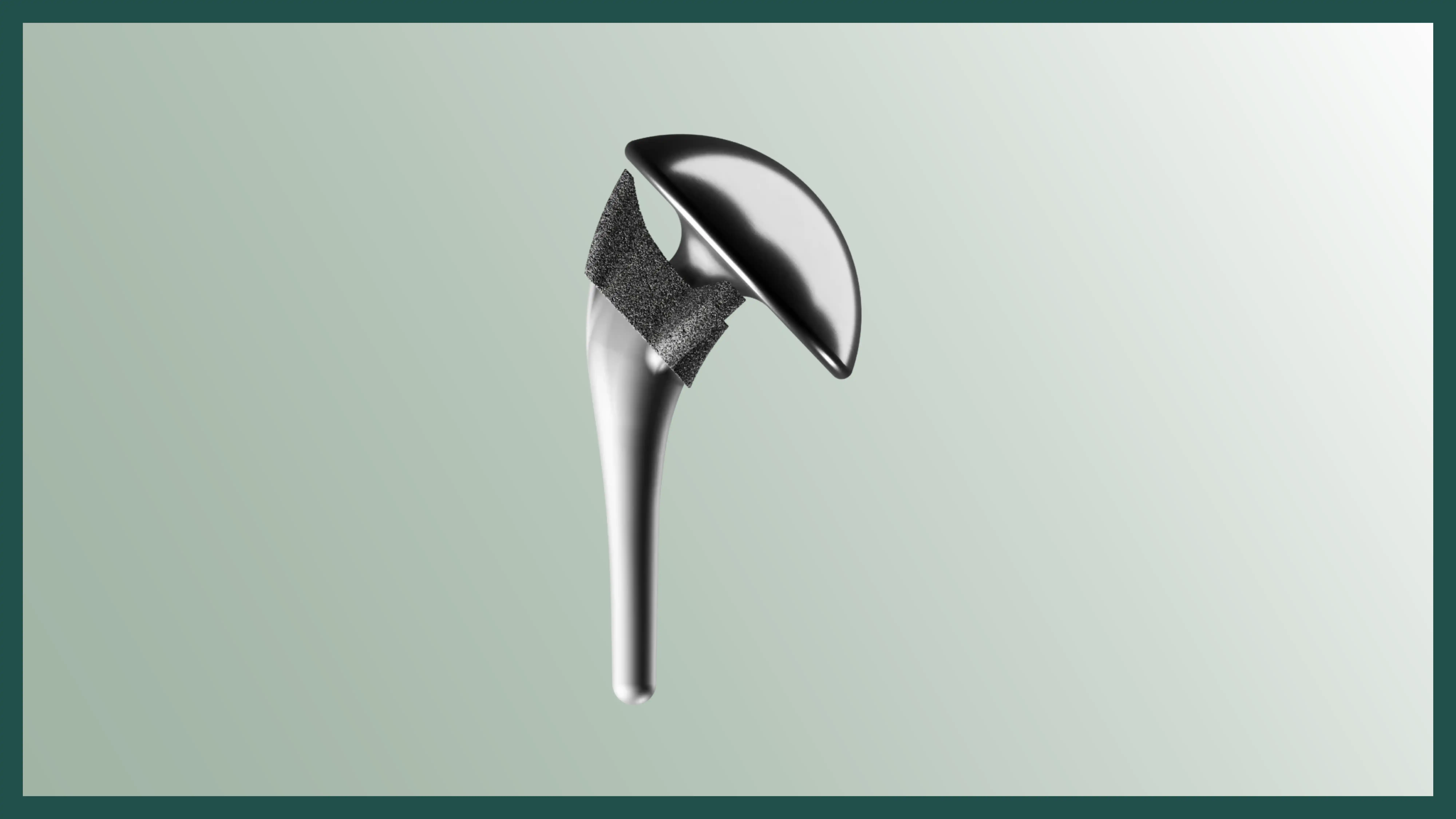 Understanding Total Shoulder Replacement