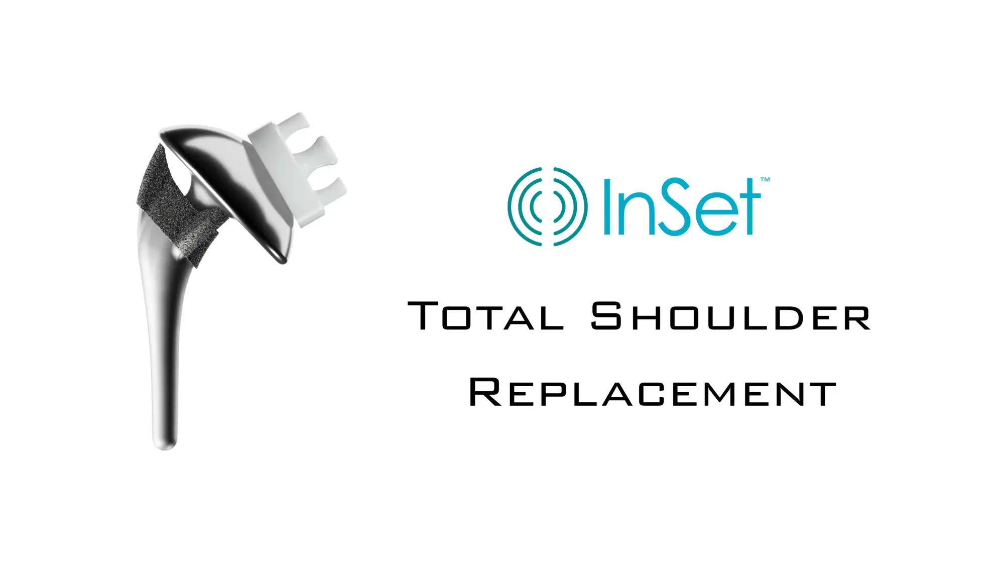 InSet™ total shoulder replacement implant