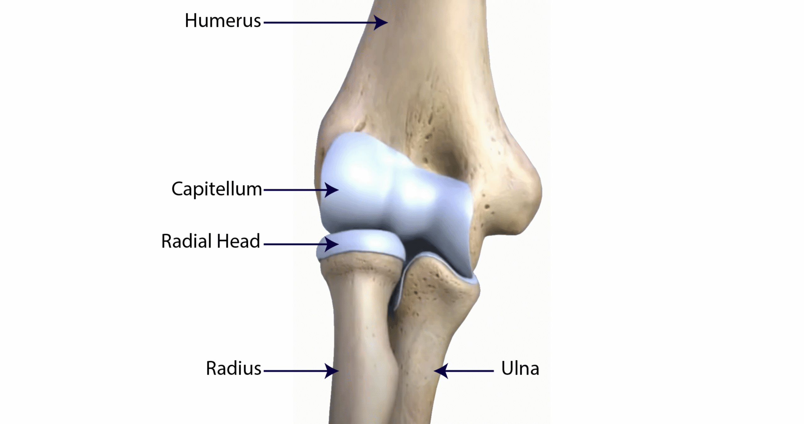 Radial head, capitellum, olecranon