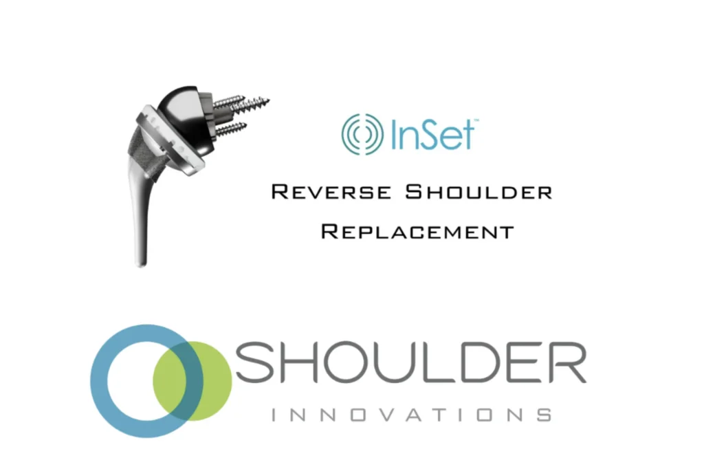 Total shoulder replacement implant