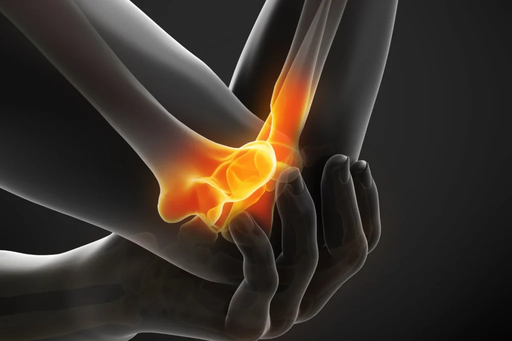 Elbow Pain Anatomy
