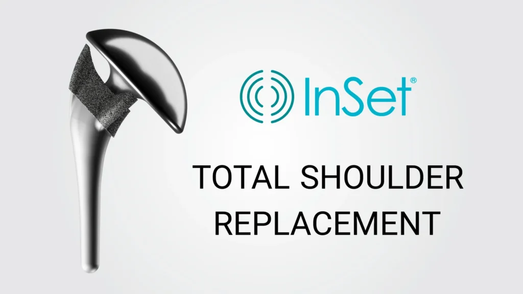 Implant Images TSA InSet® technology for total shoulder replacement procedures.