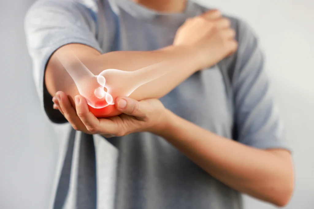 patient with elbow arthritis patient suffering from elbow arthritis.